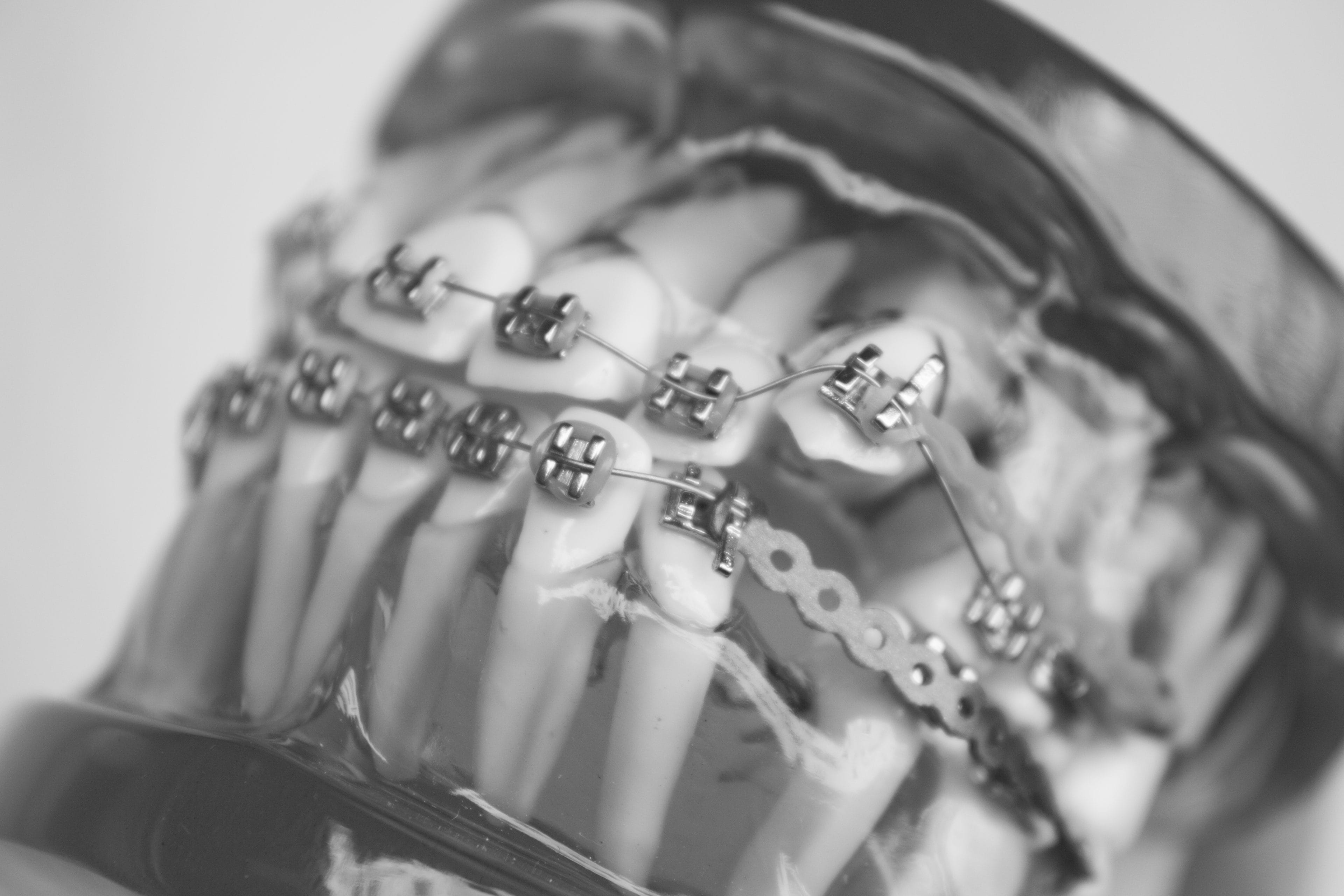 high angle view drink table